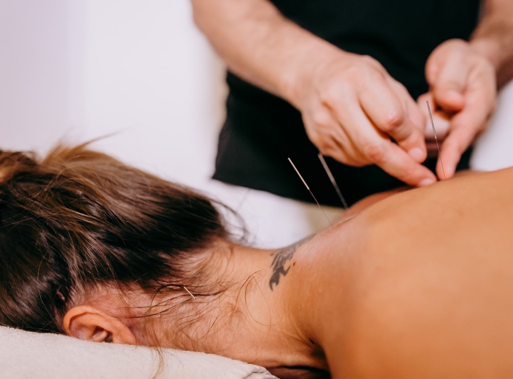 A woman receiving acupressure treatment, with a therapist applying pressure on specific points of her body.